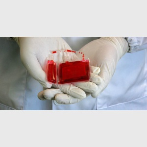 خون بند ناف